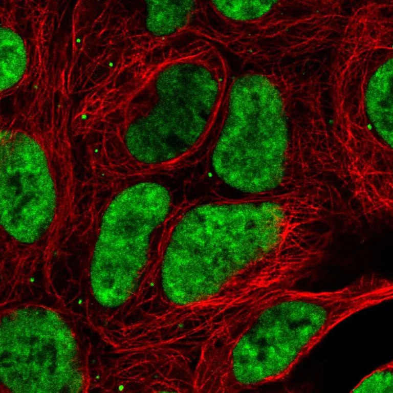 Immunocytochemistry/ Immunofluorescence - Anti-DDX17 Antibody (AB327257)