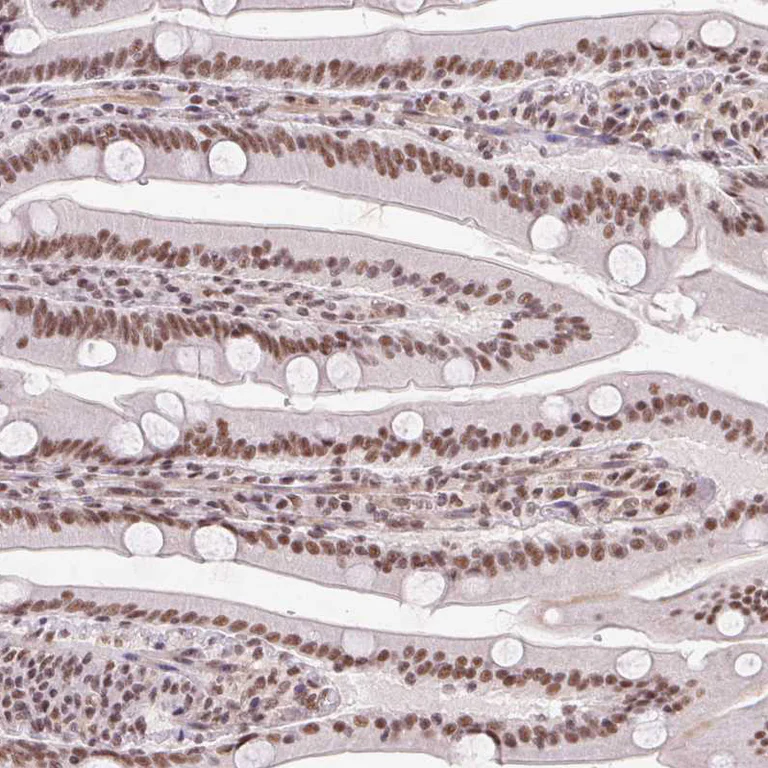 Immunohistochemistry (Formalin/PFA-fixed paraffin-embedded sections) - Anti-DDX17 Antibody (AB327257)