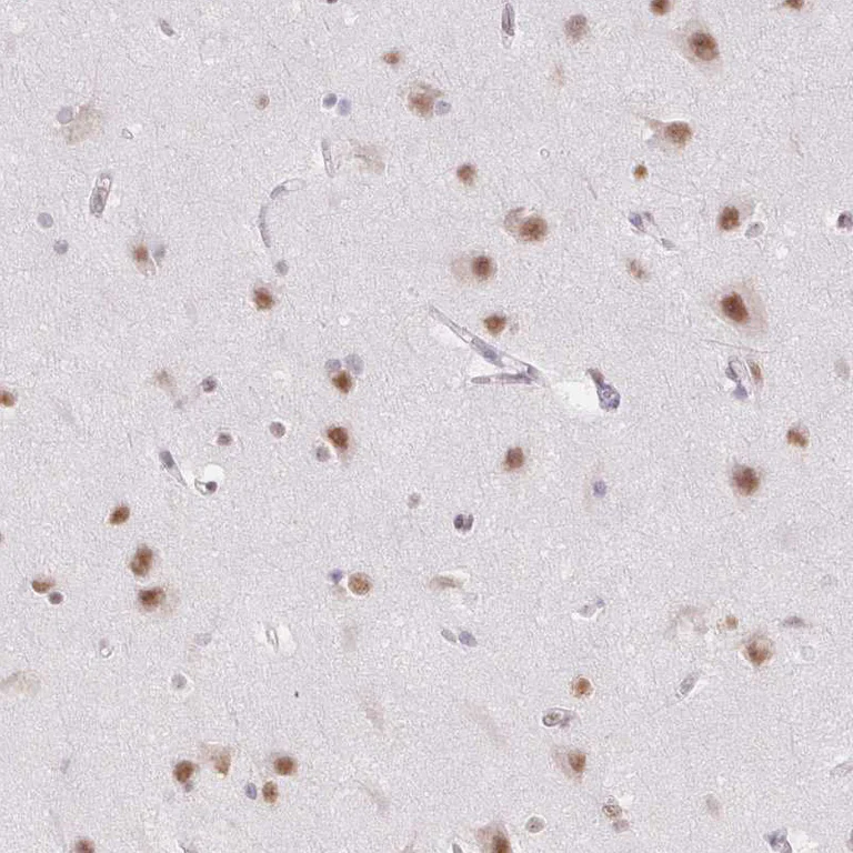 Immunohistochemistry (Formalin/PFA-fixed paraffin-embedded sections) - Anti-DDX17 Antibody (AB327257)