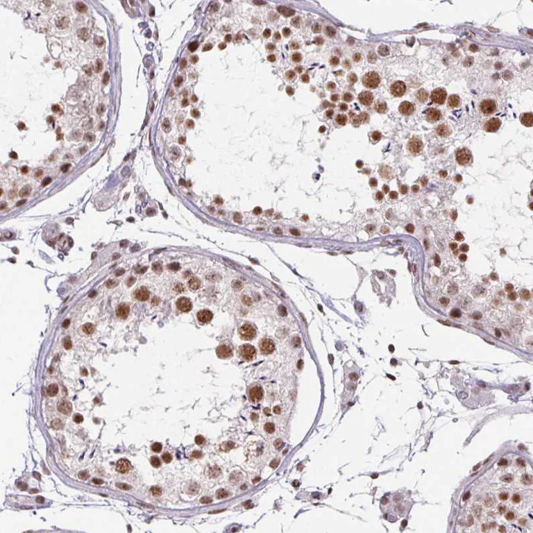 Immunohistochemistry (Formalin/PFA-fixed paraffin-embedded sections) - Anti-DDX17 Antibody (AB327257)