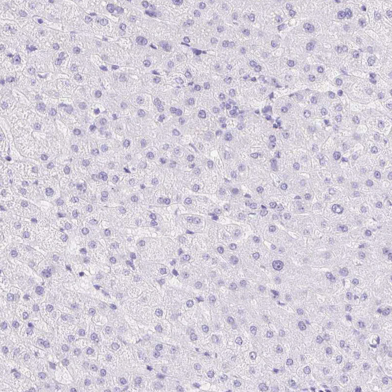 Immunohistochemistry (Formalin/PFA-fixed paraffin-embedded sections) - Anti-DDX17 Antibody (AB327257)