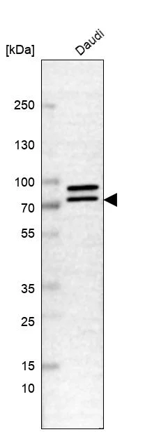 Western blot - Anti-DDX17 Antibody (AB327257)