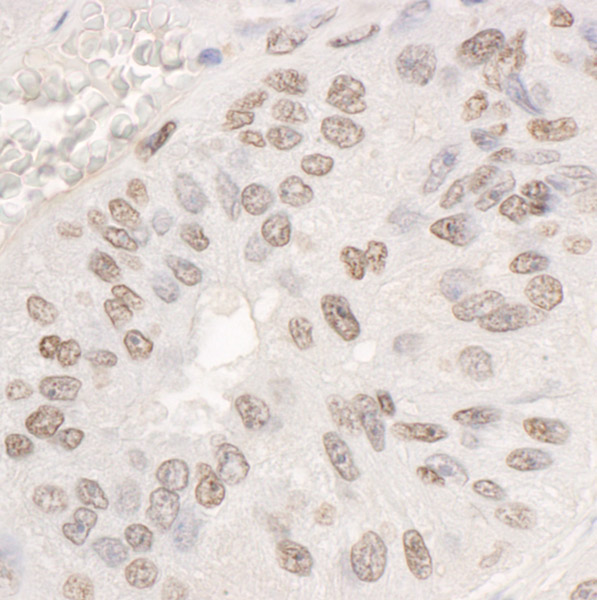 Immunohistochemistry (Formalin/PFA-fixed paraffin-embedded sections) - Anti-DDX17 antibody (AB70184), expandable thumbnail