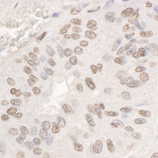 Immunohistochemistry (Formalin/PFA-fixed paraffin-embedded sections) - Anti-DDX17 antibody (AB70184)