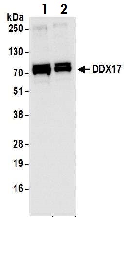 Western blot - Anti-DDX17 antibody (AB70184), expandable thumbnail