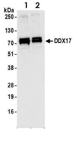Western blot - Anti-DDX17 antibody (AB70184)