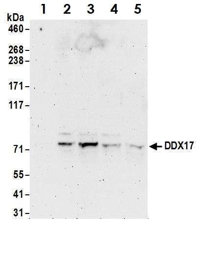 Western blot - Anti-DDX17 antibody (AB70184), expandable thumbnail