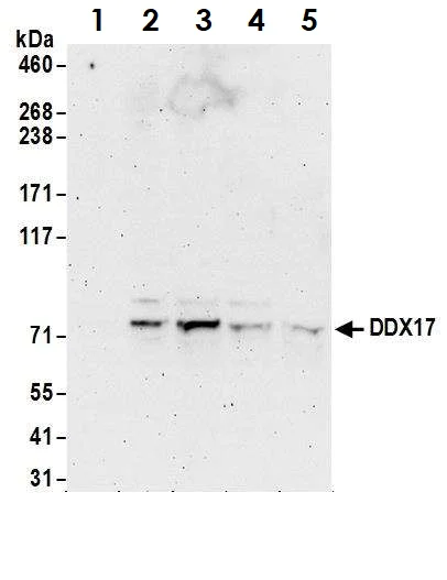 Western blot - Anti-DDX17 antibody (AB70184)