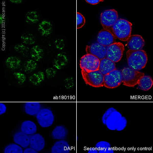 Immunocytochemistry/ Immunofluorescence - Anti-DDX17 antibody [EPR13807(B)] (AB180190)