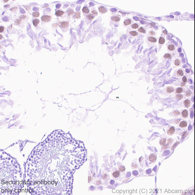 Immunohistochemistry (Formalin/PFA-fixed paraffin-embedded sections) - Anti-DDX17 antibody [EPR13807(B)] (AB180190)