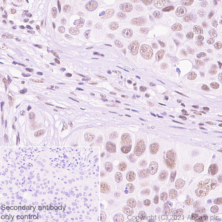Immunohistochemistry (Formalin/PFA-fixed paraffin-embedded sections) - Anti-DDX17 antibody [EPR13807(B)] (AB180190)