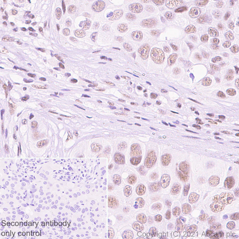 Immunohistochemistry (Formalin/PFA-fixed paraffin-embedded sections) - Anti-DDX17 antibody [EPR13807(B)] (AB180190)