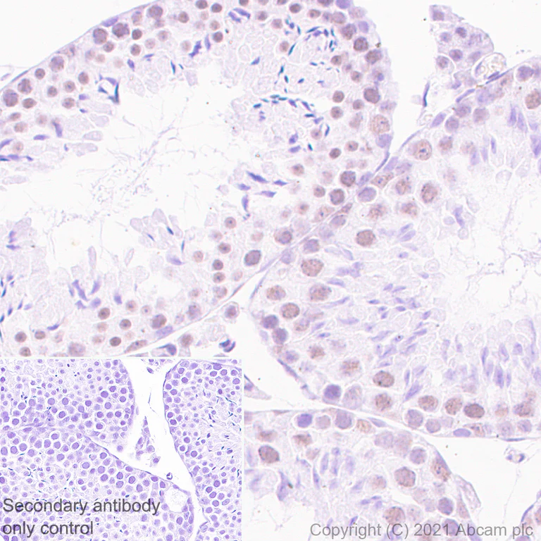 Immunohistochemistry (Formalin/PFA-fixed paraffin-embedded sections) - Anti-DDX17 antibody [EPR13807(B)] - BSA and Azide free (AB250190)