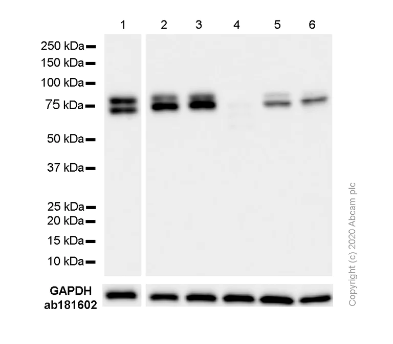 Western blot - Anti-DDX17 antibody [EPR13807(B)] - BSA and Azide free (AB250190)