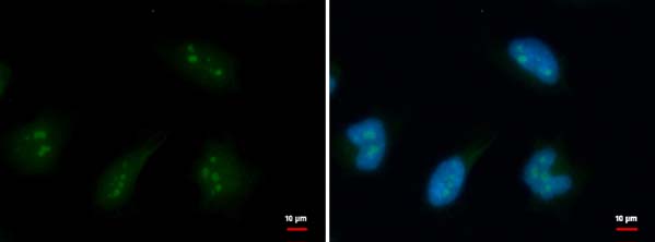 Immunocytochemistry/ Immunofluorescence - Anti-DDX18 antibody (AB183853), expandable thumbnail