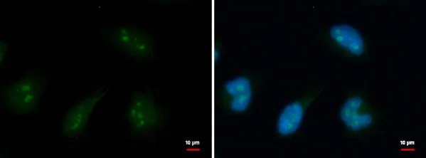 Immunocytochemistry/ Immunofluorescence - Anti-DDX18 antibody (AB183853)