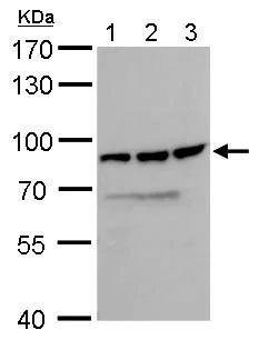 Western blot - Anti-DDX18 antibody (AB183853)
