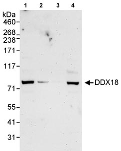 Western blot - Anti-DDX18 antibody (AB70527)