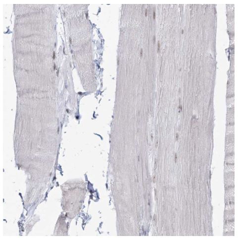Immunohistochemistry (Formalin/PFA-fixed paraffin-embedded sections) - Anti-DDX21 antibody (AB244457)