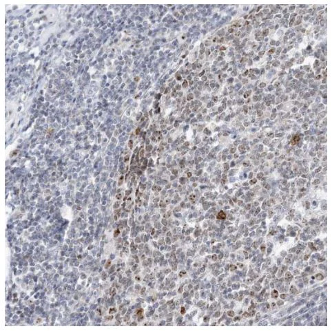 Immunohistochemistry (Formalin/PFA-fixed paraffin-embedded sections) - Anti-DDX21 antibody (AB244457)