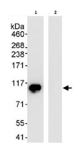 Immunoprecipitation - Anti-DDX21 antibody (AB264137)