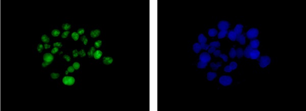 Immunocytochemistry/ Immunofluorescence - Anti-DDX21 antibody [EPR14495] (ab182156), expandable thumbnail