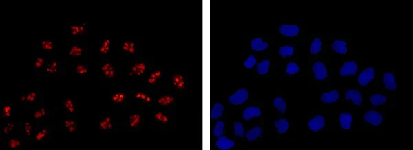 Immunocytochemistry/ Immunofluorescence - Anti-DDX21 antibody [EPR14495] (AB182156)
