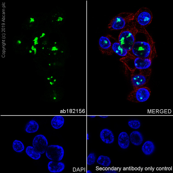 Immunocytochemistry/ Immunofluorescence - Anti-DDX21 antibody [EPR14495] (AB182156), expandable thumbnail