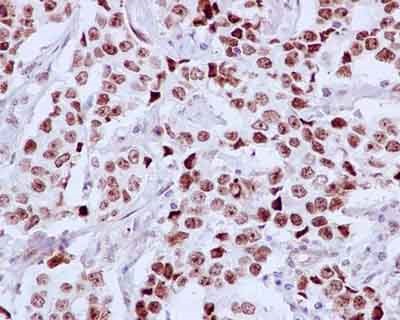 Immunohistochemistry (Formalin/PFA-fixed paraffin-embedded sections) - Anti-DDX21 antibody [EPR14495] (AB182156), expandable thumbnail