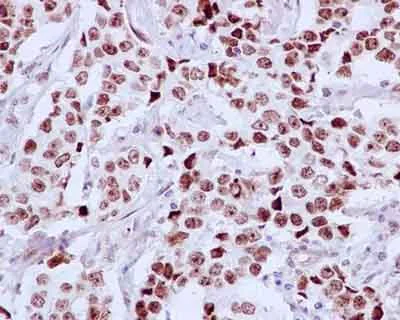 Immunohistochemistry (Formalin/PFA-fixed paraffin-embedded sections) - Anti-DDX21 antibody [EPR14495] (AB182156)