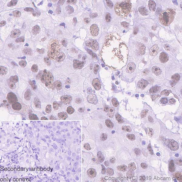 Immunohistochemistry (Formalin/PFA-fixed paraffin-embedded sections) - Anti-DDX21 antibody [EPR14495] (AB182156), expandable thumbnail