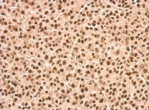 Immunohistochemistry (Formalin/PFA-fixed paraffin-embedded sections) - Anti-DDX23 antibody (AB228999)
