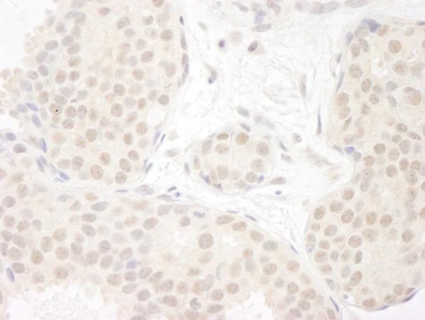 Immunohistochemistry (Formalin/PFA-fixed paraffin-embedded sections) - Anti-DDX23 antibody (AB70459)