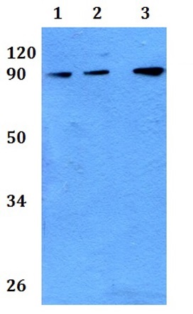 Western blot - Anti-DDX24 antibody (AB201080)