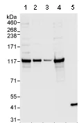 Western blot - Anti-DDX24 antibody (AB70462)