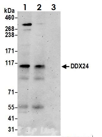 Immunoprecipitation - Anti-DDX24 antibody (AB70463)
