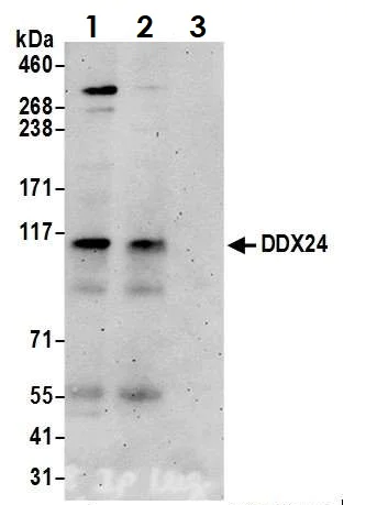 Immunoprecipitation - Anti-DDX24 antibody (AB70463)