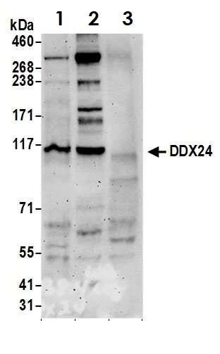 Western blot - Anti-DDX24 antibody (AB70463)