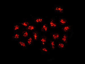 Immunocytochemistry/ Immunofluorescence - Anti-DDX27 antibody [EPR13146(B)] (AB177938)