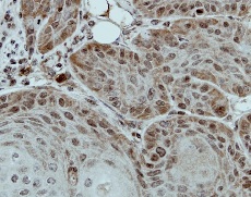 Immunohistochemistry (Formalin/PFA-fixed paraffin-embedded sections) - Anti-DDX28 antibody (AB154667)