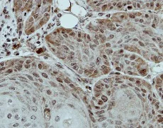 Immunohistochemistry (Formalin/PFA-fixed paraffin-embedded sections) - Anti-DDX28 antibody (AB154667)