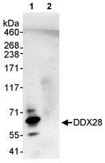 Immunoprecipitation - Anti-DDX28 antibody (AB70821)