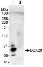 Immunoprecipitation - Anti-DDX28 antibody (AB70821)