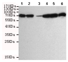 Western blot - Anti-DDX3 antibody [6G8-F4-E3] (AB196032), expandable thumbnail