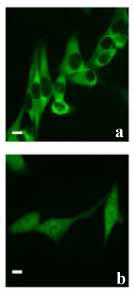 Immunocytochemistry/ Immunofluorescence - Anti-DDX3 antibody (AB128206)
