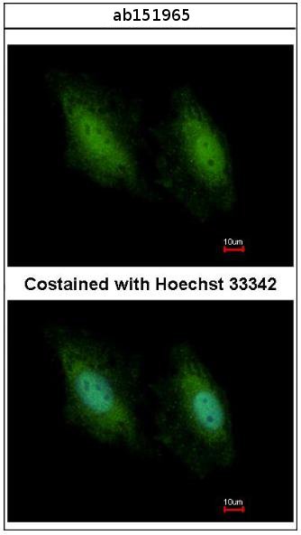 Immunocytochemistry/ Immunofluorescence - Anti-DDX3 antibody (AB151965), expandable thumbnail