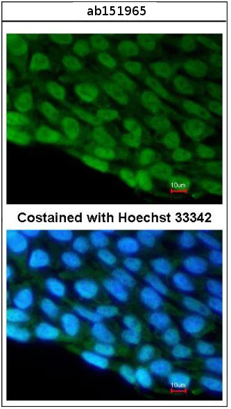 Immunocytochemistry/ Immunofluorescence - Anti-DDX3 antibody (AB151965)