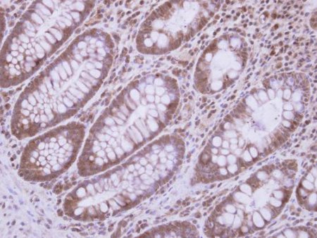 Immunohistochemistry (Formalin/PFA-fixed paraffin-embedded sections) - Anti-DDX3 antibody (AB151965), expandable thumbnail