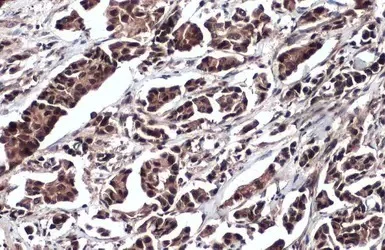 Immunohistochemistry (Formalin/PFA-fixed paraffin-embedded sections) - Anti-DDX3 antibody (AB151965)
