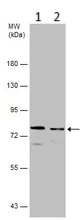 Western blot - Anti-DDX3 antibody (AB151965)
